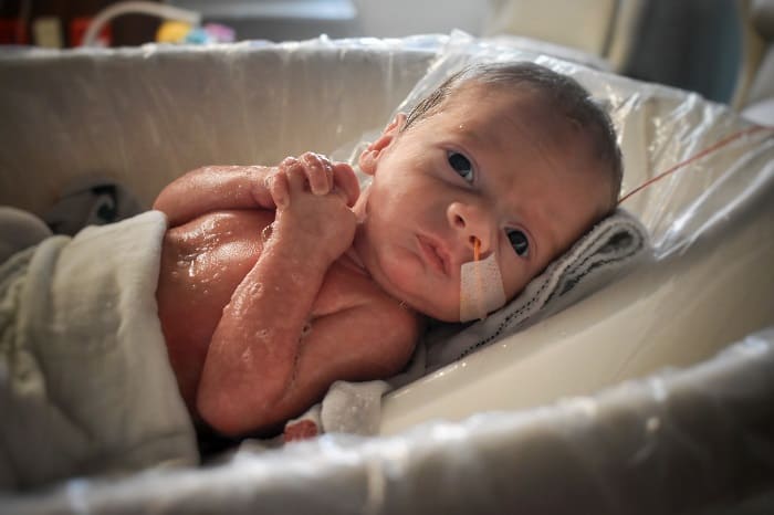 prenatal tests wrong 85 01