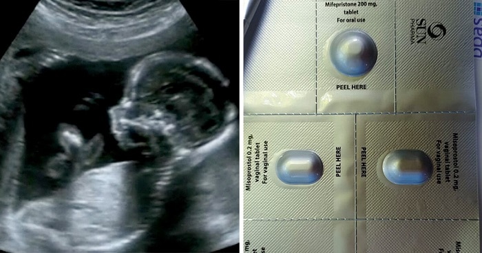 study falsely claiming abortion pill is safe for women is completely bogus 02