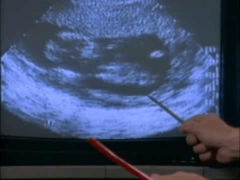 bernard nathanson 02