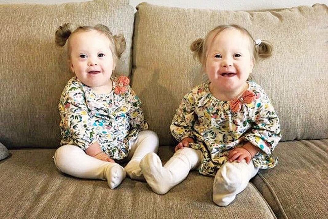 Identical twin pregnancy